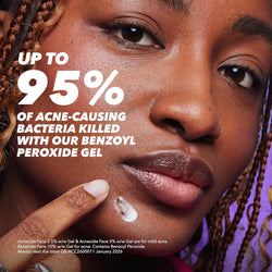Acnecide Face Gel 5% Benzoyl Peroxide 15g – Treatment for Mild Facial Acne & Spots