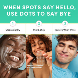 Dots for Spots Hydrocolloid Spot Patches – Translucent Blemish Stickers, Vegan & Cruelty-Free, 60 Pack