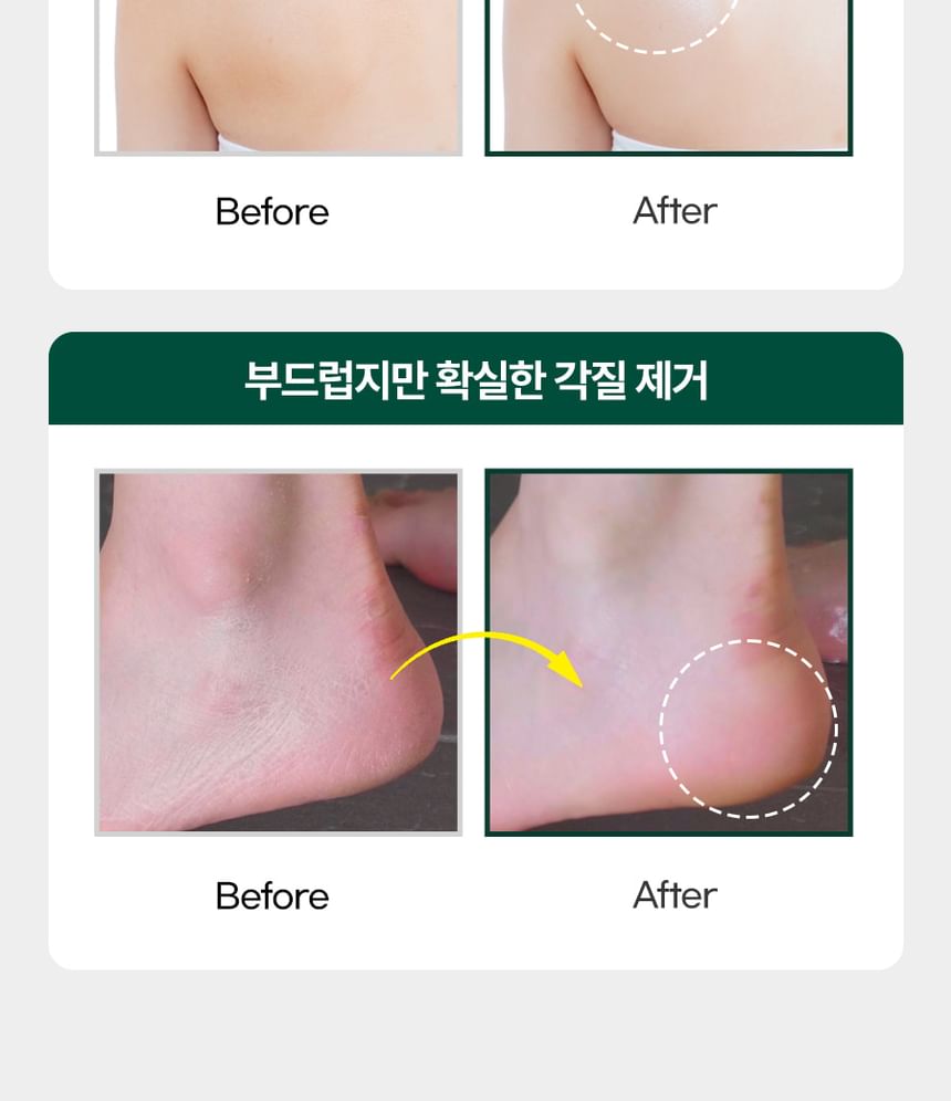 Body Scrub - 4 Types